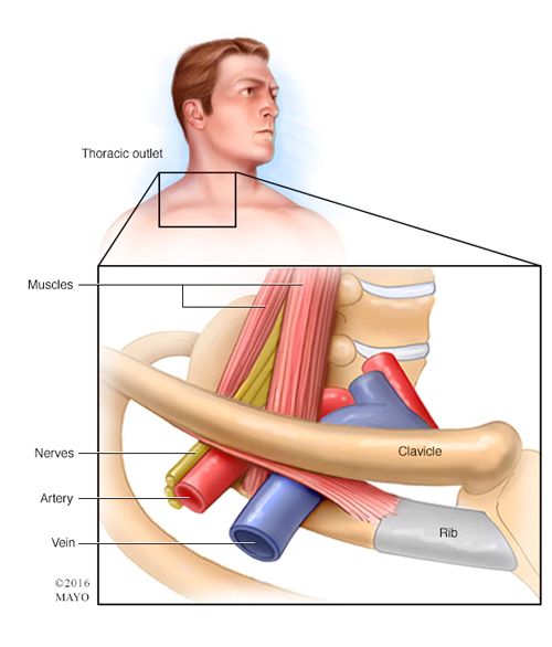 Chemoport Insertion for Cancer Chemotherapy, Dr. Kushan Nanavati